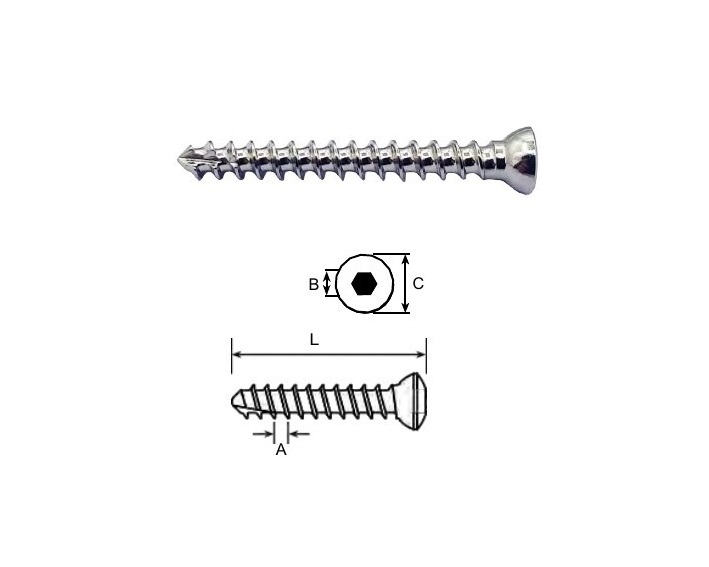 3.0mm Cancellous Screws Full Thread Stainless steel (100 ITEMS PER LOT)