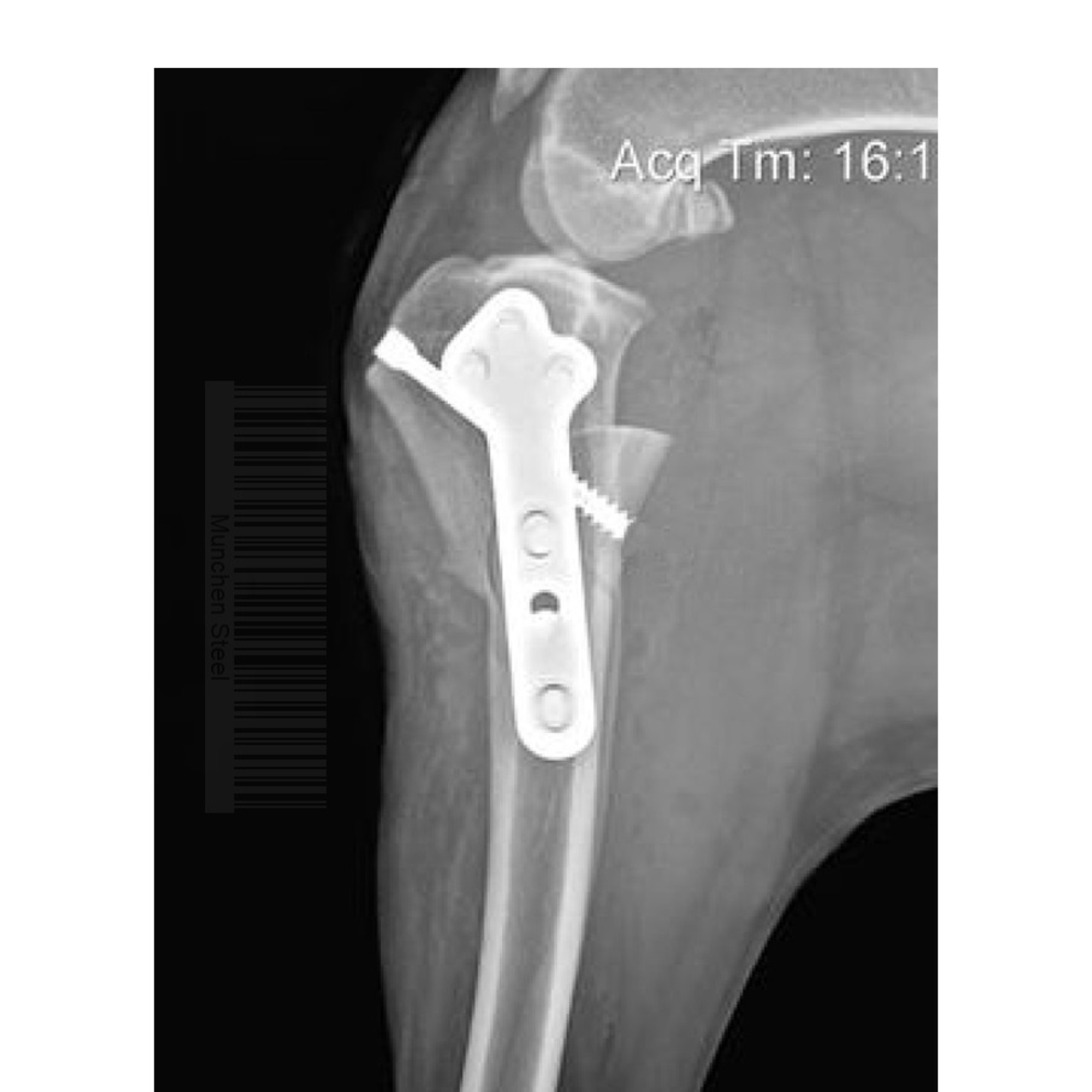 Vet HCS Headless Compression Screw Instruments Set - Image 2